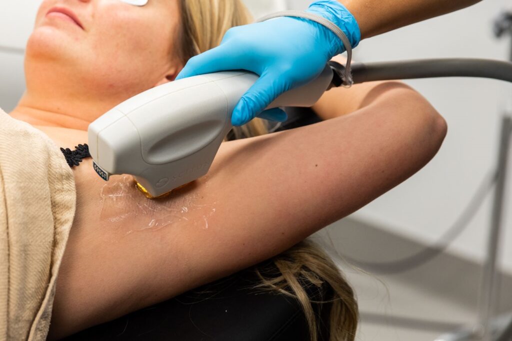 A woman gets laser hair removal after budgeting for medical aesthetics 