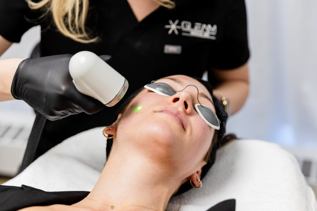 A patient receives ADATx laser resurfacing skin texture treatments in Denver, CO